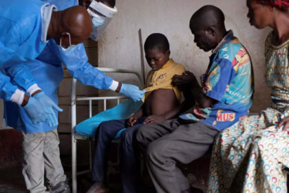 who calls for increased surveillance sharing of data vaccines to combat monkeypox outbreak डब्ल्यूएचओ ने मंकीपॉक्स प्रकोप से निपटने के लिए निगरानी बढ़ाने, डेटा साझा करने और टीके लगाने का आह्वान किया, ईटी हेल्थवर्ल्ड