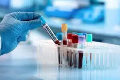 fats in blood with inflammation could better predict heart disease risk in women study finds अध्ययन में पाया गया कि रक्त में वसा, सूजन के साथ, महिलाओं में हृदय रोग के जोखिम की बेहतर भविष्यवाणी कर सकती है, ईटी हेल्थवर्ल्ड