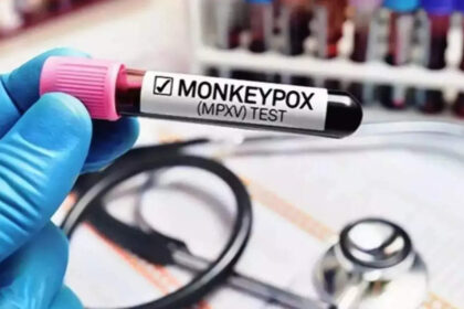 india has not reported any mpox case since march 2024 sources भारत में मार्च 2024 के बाद से एमपॉक्स का कोई मामला सामने नहीं आया है: सूत्र, ईटी हेल्थवर्ल्ड