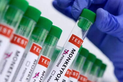 suspected mpox case in delhi health ministry says no cause of alarm दिल्ली में संदिग्ध एमपॉक्स मामले पर स्वास्थ्य मंत्रालय ने कहा, चिंता की कोई बात नहीं, ईटी हेल्थवर्ल्ड