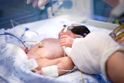 in maharashtra over 80 kids aged 6 23 months lack dietary diversity says study ईटी हेल्थवर्ल्ड के अध्ययन के अनुसार, महाराष्ट्र में 6-23 महीने की उम्र के 80% से अधिक बच्चों में आहार विविधता का अभाव है