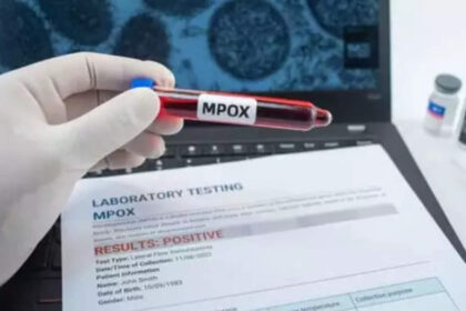 who approves first mpox diagnostic test for emergency use डब्ल्यूएचओ ने आपातकालीन उपयोग के लिए पहले एमपॉक्स डायग्नोस्टिक परीक्षण को मंजूरी दी, हेल्थ न्यूज, ईटी हेल्थवर्ल्ड