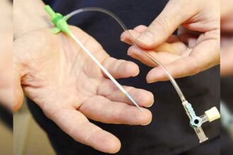 health ministry asked to examine coronary stent safety concerns Urgent Review of Coronary Stent Safety Amid Quality Concerns Raised in Parliament, ETHealthworld